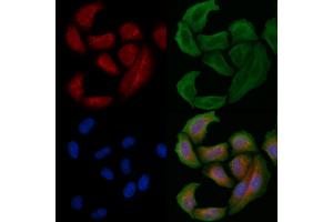 ABIN6261604 and ABIN6266802 staining Hela cells by IF/ICC. (EPS8-Like 2 Antikörper  (N-Term))