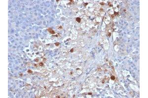Image no. 3 for anti-Melanoma Cell Adhesion Molecule (MCAM) antibody (ABIN6153300) (MCAM Antikörper)