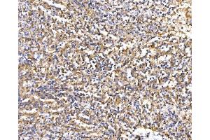 IHC analysis of Epac1/RAPGEF3 using anti-Epac1/RAPGEF3 antibody (ABIN7601858). (RAPGEF3 Antikörper  (AA 49-881))
