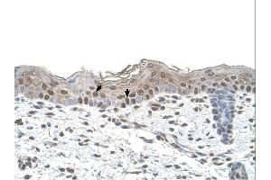 IHC Information: Human skin. (Arrestin 3 Antikörper  (Middle Region))