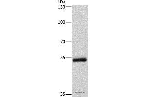 Western blot analysis of Human colon cancer tissue, using CYP2B6 Polyclonal Antibody at dilution of 1:400 (CYP2B6 Antikörper)