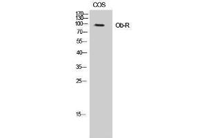 Western Blotting (WB) image for anti-Leptin Receptor (LEPR) (Ser75) antibody (ABIN3176436) (Leptin Receptor Antikörper  (Ser75))