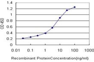 Detection limit for recombinant GST tagged ERN1 is approximately 0. (ERN1 Antikörper  (AA 401-500))