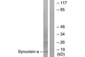 Western blot analysis of extracts from 293 cells, treated with Etoposide 25myM 60', using Synuclein-alpha (Ab-133) Antibody. (SNCA Antikörper  (AA 91-140))