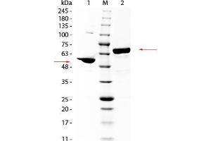 SDS PAGE of Human Albumin. (Albumin Protein (ALB))