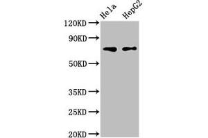 Western Blot Positive WB detected in: Hela whole cell lysate, HepG2 whole cell lysate All lanes: FRMD6 antibody at 3 μg/mL Secondary Goat polyclonal to rabbit IgG at 1/50000 dilution Predicted band size: 73, 71, 30 kDa Observed band size: 73 kDa (FRMD6 Antikörper  (AA 413-622))