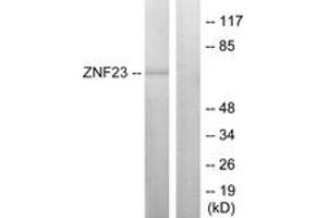 Western blot analysis of extracts from LOVO cells, using ZNF23 Antibody. (ZNF23 Antikörper  (AA 151-200))