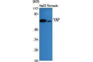 Western Blot (WB) analysis of specific cells using YAP Polyclonal Antibody. (YAP1 Antikörper  (Tyr537))