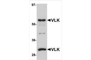 Western blot analysis of VLK in human lung tissue lysate with VLK antibody at 1 μg/ml. (PKDCC Antikörper  (Center))
