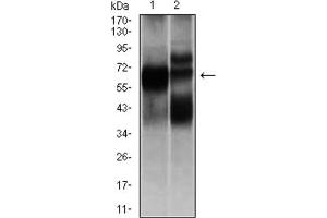 Western Blotting (WB) image for anti-Hexosaminidase A (HEXA) antibody (ABIN1846273)