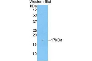 Western blot analysis of the recombinant protein. (Biglycan Antikörper  (AA 243-369))
