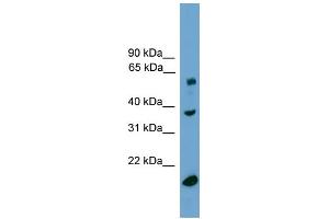 WB Suggested Anti-TBL1Y Antibody Titration:  0.