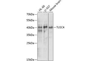 Western blot analysis of extracts of various cell lines, using NPRL2 antibody (ABIN6132809, ABIN6144787, ABIN6144788 and ABIN6221564) at 1:1000 dilution. (NPRL2 Antikörper  (AA 1-220))