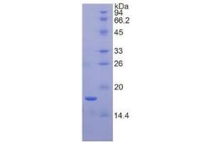 SDS-PAGE (SDS) image for Periostin (POSTN) ELISA Kit (ABIN6574325)