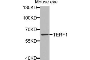 Western blot analysis of extracts of mouse eye, using TERF1 antibody (ABIN5970015) at 1/1000 dilution. (TRF1 Antikörper)