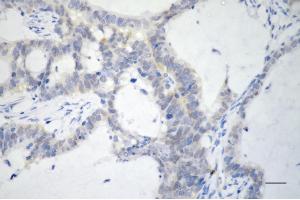 anti-Cyclin-Dependent Kinase 16 (CDK16) antibody