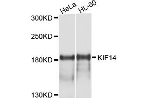 Western blot analysis of extracts of various cell lines, using KIF14 antibody (ABIN4904151) at 1:1000 dilution. (KIF14 Antikörper)