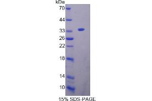 Image no. 1 for Oncoprotein Induced Transcript 3 (OIT3) (AA 251-524) protein (His tag) (ABIN4988831)