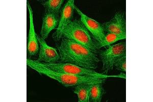 IF analysis of SPRED2 using anti-SPRED2 antibody (ABIN7601643) and anti-Tubulin Alpha antibody (ABIN7600339).
