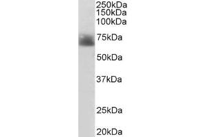 ABIN185394 (2µg/ml) staining of Human Colon lysate (35µg protein in RIPA buffer). (SLC6A4 Antikörper  (Internal Region))