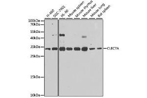 Western Blotting (WB) image for anti-C-Type Lectin Domain Family 7, Member A (CLEC7A) (C-Term) antibody (ABIN6138717)