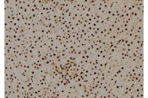 ABIN6269146 at 1/100 staining Rat liver tissue by IHC-P. (Cyclin B1 Antikörper  (Internal Region))