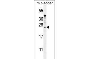 KI Antibody (N-term) (ABIN654385 and ABIN2844131) western blot analysis in mouse bladder tissue lysates (35 μg/lane). (SHISAL1/KIAA1644 Antikörper  (N-Term))
