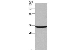 Western Blot analysis of Human fetal brain tissue using DKK3 Polyclonal Antibody at dilution of 1:200 (DKK3 Antikörper)
