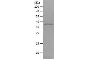 Western Blotting (WB) image for Small Nuclear Ribonucleoprotein Polypeptide F (SNRPF) (AA 1-180) protein (His-IF2DI Tag) (ABIN7282346) (SNRPF Protein (AA 1-180) (His-IF2DI Tag))