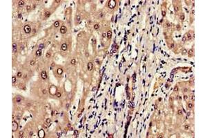 Immunohistochemistry of paraffin-embedded human liver tissue using ABIN7151655 at dilution of 1:100