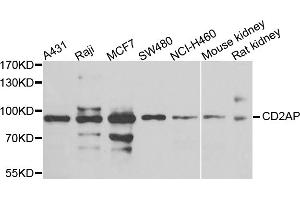 Western blot analysis of extracts of various cell lines, using CD2AP antibody (ABIN5975643) at 1/1000 dilution.