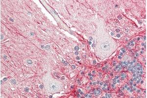 Immunohistochemistry (IHC) image for anti-Amyloid beta (A4) Precursor Protein (APP) (N-Term) antibody (ABIN870659)