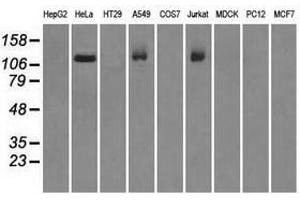 Image no. 2 for anti-Budding Uninhibited By Benzimidazoles 1 Homolog beta (Yeast) (BUB1B) antibody (ABIN1496996) (BUB1B Antikörper)