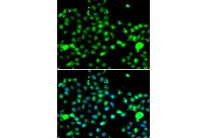 Immunofluorescence analysis of A549 cells using IP6K2 antibody. (IP6K2 Antikörper)