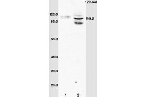 L1 rat brain lysates L2 rat liver lysates probed with Anti Phospho-STAT6(Tyr641) Polyclonal Antibody, Unconjugated (1791R) at 1:200 overnight at 4 °C. (STAT6 Antikörper  (pTyr641))