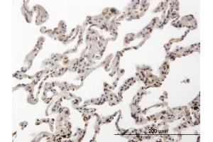 Immunoperoxidase of monoclonal antibody to HMG2L1 on formalin-fixed paraffin-embedded human lung. (HMGXB4 Antikörper  (AA 1-74))