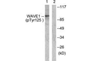 Western blot analysis of extracts from NIH-3T3 cells treated with Insulin 0. (WASF1 Antikörper  (pTyr125))