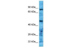Host: Rabbit Target Name: TMPRSS11B Sample Type: Hela Whole Cell lysates Antibody Dilution: 1.