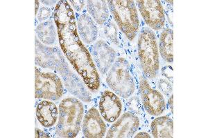 Immunohistochemistry of paraffin-embedded mouse kidney using GRPEL2 Rabbit pAb (ABIN6132810, ABIN6141437, ABIN6141438 and ABIN6224364) at dilution of 1:200 (40x lens). (GRPEL2 Antikörper  (AA 33-225))
