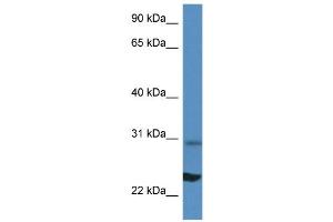 WB Suggested Anti-Rpl17 Antibody Titration: 1. (RPL17 Antikörper  (N-Term))