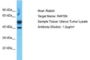 Host:  Rabbit  Target Name:  RAPSN  Sample Type:  Uterus Tumor lysates  Antibody Dilution:  1. (RAPSN Antikörper  (C-Term))