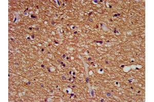 IHC image of ABIN7145619 diluted at 1:500 and staining in paraffin-embedded human brain tissue performed on a Leica BondTM system. (FHIT Antikörper  (AA 2-147))