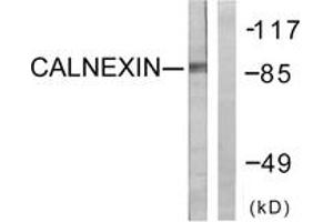 Western blot analysis of extracts from HeLa cells, treated with EGF 200ng/ml 30', using Calnexin (Ab-583) Antibody. (Calnexin Antikörper  (AA 543-592))