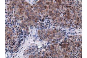 Immunohistochemical staining of paraffin-embedded Human pancreas tissue using anti-VWA5A mouse monoclonal antibody. (VWA5A Antikörper)