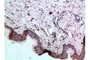 Immunohistochemical analysis of paraffin-embedded human-skin, antibody was diluted at 1:200 (BMP1 Antikörper  (AA 131-180))
