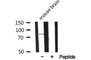 Western blot analysis of extracts from mouse Brian, using MARK2 antibody. (MARK2 Antikörper  (Internal Region))