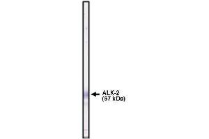Image no. 1 for anti-Activin Receptor Type I (ACRV1) (Extracellular Domain) antibody (ABIN265018)