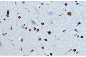 Immunohistochemistry of paraffin-embedded Mouse spinal cord using Acetyl-Histone H4-K12 Polyclonal Antibody at dilution of 1:200 (40x lens). (Histone H4 Antikörper  (acLys12))