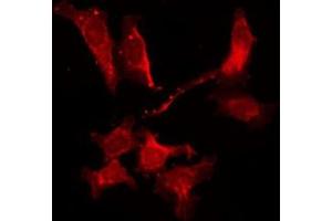 ABIN6278549 staining Hela by IF/ICC. (Adenosine A2b Receptor Antikörper  (Internal Region))