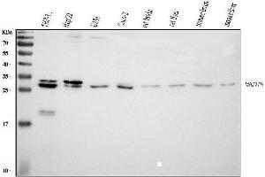 Western blot analysis of MED8 using anti-MED8 antibody (ABIN5519031). (MED8 Antikörper  (AA 1-195))